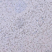 IHC staining of FFPE rat brain with PSF antibody. HIER: boil tissue sections in pH8 EDTA for 20 min and allow to cool before testing.
