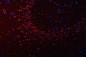 Immunofluorescent staining of FFPE mouse brain cancer tissue with PSF antibody (red) and DAPI nuclear stain (blue). HIER: steam section in pH8 EDTA buffer for 20 min.