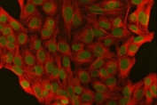 Immunofluorescent staining of FFPE human MCF7 cells with PSF antibody (green) and Alpha Tubulin antibody (red). HIER: steam section in pH6 citrate buffer for 20 min.