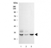 Western blot testing of human 1) 293T, 2) HepG2 and 3) HL60 cell lysate with SBDS antibody. Predicted molecular weight ~29 kDa.