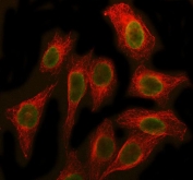 Immunofluorescent staining of FFPE human U-2 OS cells with SBDS antibody (green) and Beta Tubulin mAb (red). HIER: steam section in pH6 citrate buffer for 20 min.