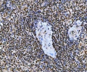 IHC staining of FFPE human spleen tissue with UBE2N antibody. HIER: boil tissue sections in pH8 EDTA for 20 min and allow to cool before testing.