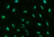 Immunofluorescent staining of FFPE human A549 cells with GNB1 antibody. HIER: steam section in pH6 citrate buffer for 20 min.