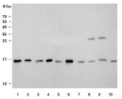 Western blot testing of 1) human Daudi, 2) human MOLT4, 3) human RT4, 4) human HEL, 5) rat heart, 6) rat thymus, 7) rat C6, 8) mouse thymus, 9) mouse small intestine and 10) mouse NIH 3T3 cell lysate with UBE2N antibody. Predicted molecular weight ~17 kDa.