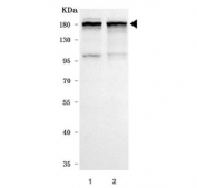 Western blot testing of human 1) HeLa and 2) A549 cell lysate with INF2 antibody. Predicted molecular weight ~136 kDa, routinely observed at 170-180 kDa.