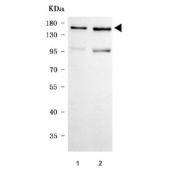 Western blot testing of human 1) A549 and 2) HeLa cell lysate with TGF beta Receptor III antibody. Predicted molecular weight ~94 kDa but may be observed at higher molecular weights due to glycosylation.