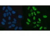 Immunofluorescent staining of FFPE human U-2 OS cells with XPO5 antibody (green) and DAPI nuclear stain (blue). HIER: steam section in pH6 citrate buffer for 20 min.