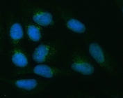 Immunofluorescent staining of FFPE human U-2 OS cells with ZNRF3 antibody (green) and DAPI nuclear stain (blue). HIER: steam section in pH6 citrate buffer for 20 min.