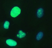 Immunofluorescent staining of FFPE human A549 cells with UBE2S antibody (green) and DAPI nuclear stain (blue). HIER: steam section in pH6 citrate buffer for 20 min.