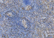 IHC staining of FFPE human spleen tissue with Tropomyosin 2 antibody. HIER: boil tissue sections in pH8 EDTA for 20 min and allow to cool before testing.