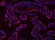 Immunofluorescent staining of FFPE human placental tissue with Tropomyosin 2 antibody (red) and DAPI nuclear stain (blue). HIER: steam section in pH6 citrate buffer for 20 min.
