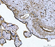 IHC staining of FFPE human placental tissue with Tropomyosin 2 antibody. HIER: boil tissue sections in pH8 EDTA for 20 min and allow to cool before testing.
