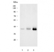Western blot testing of 1) human HeLa, 2) rat H9C2(2-1) and 3) mouse skeletal muscle tissue lysate with Tropomyosin 2 antibody. Expected molecular weight: 33-37 kDa.