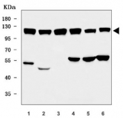 Western blot testing of 1) human MOLT-4, 2) human MCF7, 3) monkey COS-7, 4) rat testis, 5) rat C6 and 6) mouse NIH 3T3 cell lysate with UBA6 antibody. Predicted molecular weight ~118 kDa with isoforms of ~66 kDa, ~43 kDa and ~38 kDa.