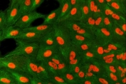 Immunofluorescent staining of FFPE human A549 cells with Tip110 antibody (red) and Alpha Tubulin antibody (green). HIER: steam section in pH6 citrate buffer for 20 min.