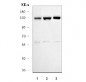 Western blot testing of human 1) HeLa, 2) K562 and 3) HEL cell lysate with Tip110 antibody. Predicted molecular weight ~110 kDa, commonly observed at 110-130 kDa.