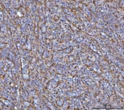 IHC staining of FFPE human spleen tissue with SAV1 antibody. HIER: boil tissue sections in pH8 EDTA for 20 min and allow to cool before testing.