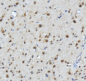 IHC staining of FFPE human brain tissue with SEC13L1 antibody, HRP-secondary and DAB substrate. HIER: boil tissue sections in pH8 EDTA for 20 min and allow to cool before testing.