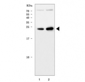 Western blot testing of 1) rat brain and 2) mouse brain tissue lysate with TPPP antibody. Predicted molecular weight ~24 kDa.
