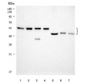 Western blot testing of 1) human LNCaP, 2) human K562, 3) human Daudi, 4) human HEL, 5) rat kidney, 6) mouse skeletal muscle and 7) mouse kidney tissue lysate with SERBP1 antibody. Predicted molecular weight ~45 kDa but observed at 45-60 kDa.