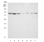 Western blot testing of 1) human HeLa, 2) human HepG2, 3) human MOLT4, 4) rat testis, 5) rat PC-12, 6) mouse testis and 7) mouse NIH 3T3 cell lysate with TKTL1 antibody. Predicted molecular weight ~65 kDa.