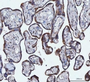 IHC staining of FFPE human placenta tissue with VAPA antibody. HIER: boil tissue sections in pH8 EDTA for 20 min and allow to cool before testing.