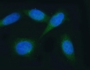 Immunofluorescent staining of FFPE human PC-3 cells with VAPA antibody (green) and DAPI nuclear stain (blue). HIER: steam section in pH6 citrate buffer for 20 min.