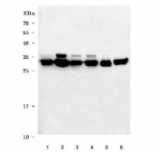 Western blot testing of 1) human HeLa, 2) human K562, 3) human 293T, 4) human HepG2, 5) rat brain and 6) mouse brain tissue lysate with VAPA antibody. Expected molecular weight: 28-33 kDa (two isoforms).