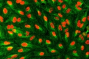 Immunofluorescent staining of FFPE human A549 cells with SART1 antibody (red) and Beta Tubulin mAb (green). HIER: steam section in pH6 citrate buffer for 20 min.