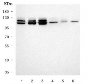 Western blot testing of 1) human HeLa, 2) human MCF7, 3) human MOLT-4, 4) rat testis, 5) mouse testis and 6) mouse thymus tissue lysate with SART1 antibody. Predicted molecular weight: ~90 kDa, routinely observed at 110-125 kDa.