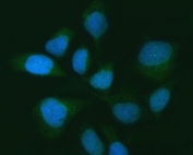 Immunofluorescent staining of FFPE human HeLa cells with Ubiquitin carboxyl-terminal hydrolase 16 antibody (green) and DAPI nuclear stain (blue). HIER: steam section in pH6 citrate buffer for 20 min.