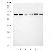 Western blot testing of human 1) MCF-7, 2) HeLa, 3) Caco-2, 4) T-47D, 5) A549 and 6) Jurkat cell lysate with TRAF7 antibody. Predicted molecular weight: 67-75 kDa (multiple isoforms).