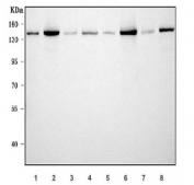 Western blot testing of 1) rat liver, 2) rat testis, 3) rat brain, 4) rat RH35, 5) mouse liver, 6) mouse testis, 7) mouse brain and 8) mouse NIH 3T3 cell lysate with Tripeptidyl-peptidase 2 antibody. Predicted molecular weight ~138 kDa.