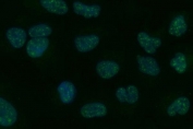 Immunofluorescent staining of FFPE human A549 cells with Tripeptidyl-peptidase 2 antibody (green) and DAPI nuclear stain (blue). HIER: steam section in pH6 citrate buffer for 20 min.