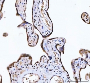 IHC staining of FFPE human placental tissue with ZMYND8 antibody. HIER: boil tissue sections in pH8 EDTA for 20 min and allow to cool before testing.