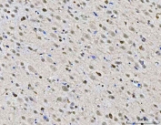 IHC staining of FFPE rat brain tissue with ZMYND8 antibody. HIER: boil tissue sections in pH8 EDTA for 20 min and allow to cool before testing.