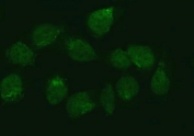 Immunofluorescent staining of FFPE human U-2 OS cells with ZMYND8 antibody. HIER: steam section in pH6 citrate buffer for 20 min.