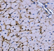 IHC staining of FFPE mouse cardiac muscle tissue with TRIM72 antibody. HIER: boil tissue sections in pH8 EDTA for 20 min and allow to cool before testing.