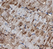 IHC staining of FFPE human skeletal muscle tissue with TRIM72 antibody. HIER: boil tissue sections in pH8 EDTA for 20 min and allow to cool before testing.