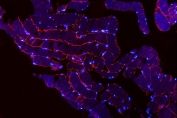 Immunofluorescent staining of FFPE human skeletal muscle tissue with TRIM72 antibody (red) and DAPI nuclear stain (blue). HIER: steam section in pH8 EDTA buffer for 20 min.