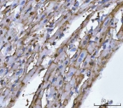 IHC staining of FFPE rat heart tissue with TRIM72 antibody. HIER: boil tissue sections in pH8 EDTA for 20 min and allow to cool before testing.