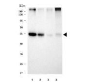 Western blot testing of 1) rat skeletal muscle, 2) rat heart, 3) mouse skeletal muscle and 4) mouse heart tissue lysate with TRIM72 antibody. Predicted molecular weight ~52 kDa.