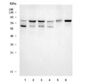 Western blot testing of 1) human 293T, 2) human T-47D, 3) human MCF7, 4) human HeLa, 5) rat brain and 6) mouse brain tissue lysate with TRIM3 antibody. Predicted molecular weight: 68-81 kDa (multiple isoforms).