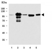 Western blot testing of 1) human ThP-1, 2) human A431, 3) human placenta, 4) rat testis and 5) mouse testis tissue lysate with TDRD7 antibody. Expected molecular weight: 124-160 kDa.