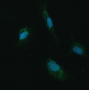 Immunofluorescent staining of FFPE human U-87 MG cells with UBC12 antibody (green) and DAPI nuclear stain (blue). HIER: steam section in pH6 citrate buffer for 20 min.