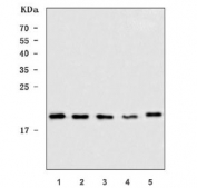 Western blot testing of 1) human 293T, 2) human Ramos, 3) human MCF7, 4) rat brain and 5) mouse brain tissue lysate with UBC12 antibody. Predicted molecular weight ~21 kDa.