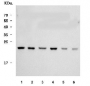 Western blot testing of 1) human Caco-2, 2) human RT4, 3) human HepG2, 4) human Daudi, 5) rat testis and 6) rat pancreas tissue lysate with Sigma-2 Receptor antibody. Predicted molecular weight ~21 kDa.