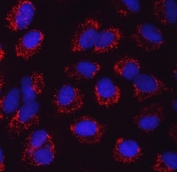 Immunofluorescent staining of FFPE human A549 cells with SerRS antibody (red) and DAPI nuclear stain (blue). HIER: steam section in pH6 citrate buffer for 20 min.