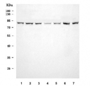 Western blot testing of human 1) RT4, 2) U-251, 3) Daudi, 4) MOLT4, 5) MCF7, 6) T-47D and 7) SH-SY5Y cell lysate with VPS51 antibody. Predicted molecular weight ~86 kDa.