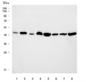 Western blot testing of human 1) Jurkat, 2) HeLa, 3) HepG2, 4) Daudi, 5) 293T, 6) Caco-2, 7) MCF7 and 8) SiHa cell lysate with THAP11 antibody. Predicted molecular weight ~34 kDa, commonly observed at 34-44 kDa.
